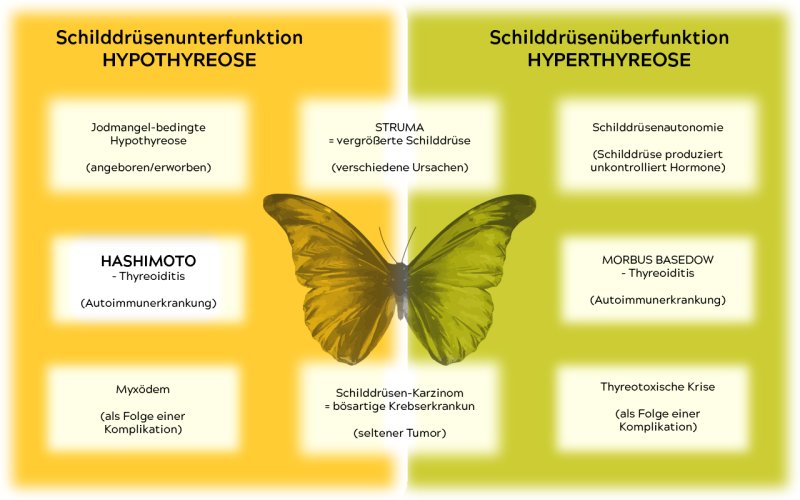 @2020 Sabine Nußbaumer, www.diaetbefreit.com Darstellung der häufigsten Ursachen von Schilddrüsenerkrankungen. Unterteilt in Schilddrüsenunter- und -überfunktion.